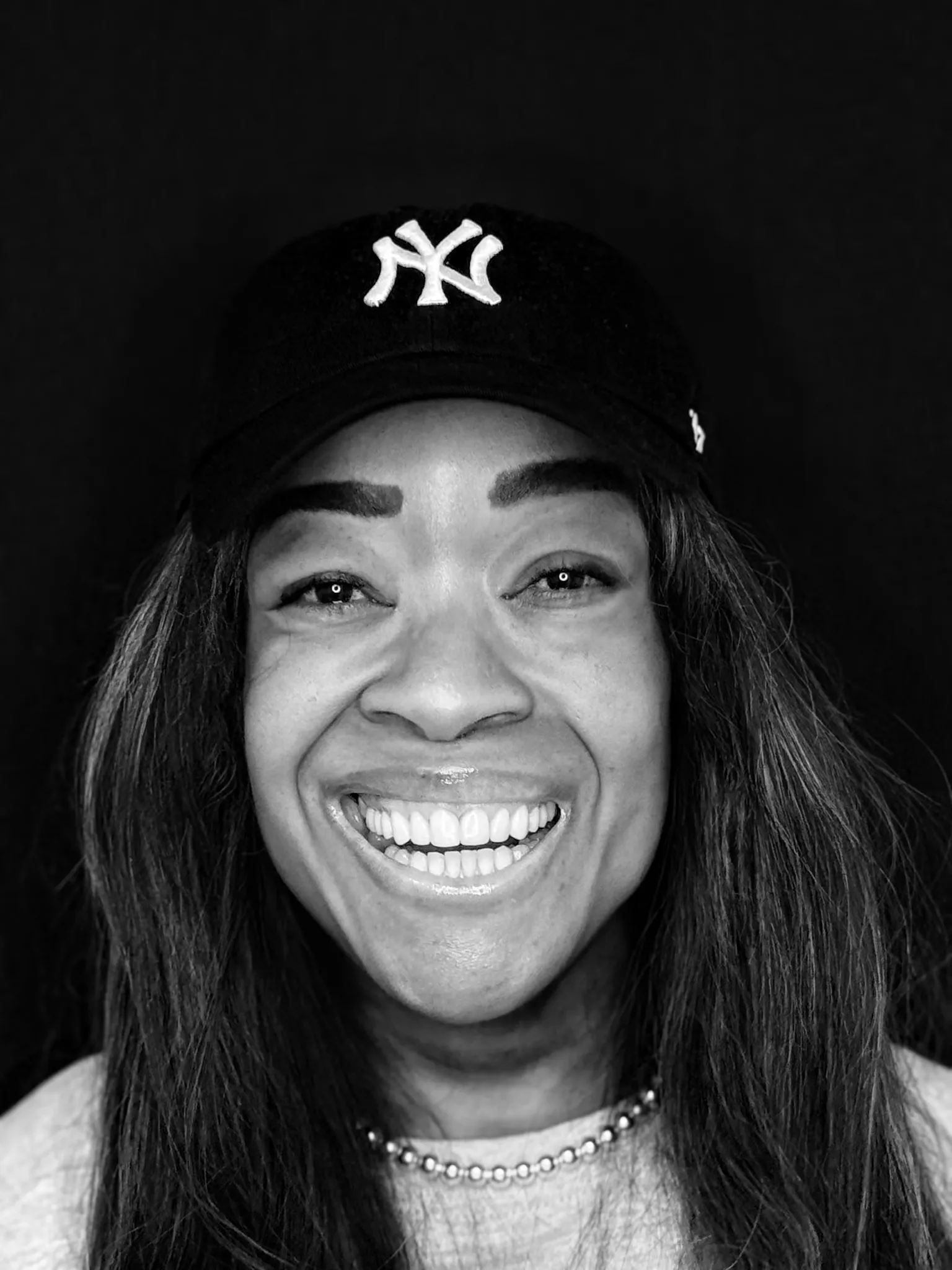 Smile Makeover · Alisha, after